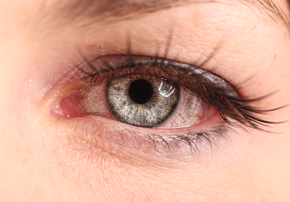 A closeup of a green eye.
